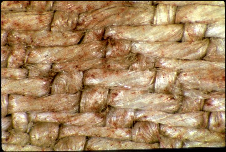 Area of the Shroud with alleged blood stains