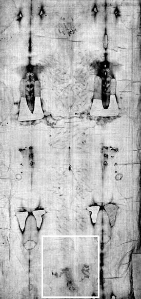 Back of feet - negative image
