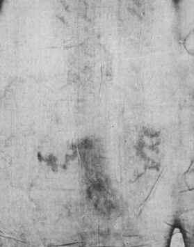 Back of feet - enlarged detail